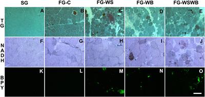 Molecular Phenotyping of White Striping and Wooden Breast Myopathies in Chicken